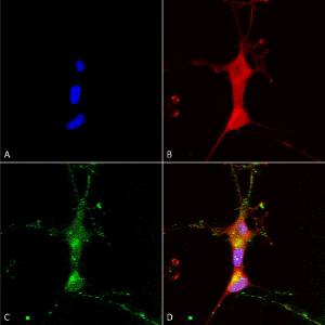 Immunocytochemistry/Immunofluorescence analysis of human neuroblastoma cells (SH-SY5Y), fixed in 4% PFA for 15 min, using Anti-TRP 7 Antibody [N64A/36] (A304950), at 1:100 for overnight at 4°C with slow rockin