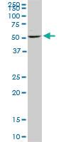 Anti-DUSP5 Mouse Monoclonal Antibody [clone: 2F3]