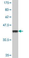 Anti-SETDB1 Mouse Polyclonal Antibody