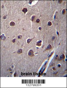 Anti-KCTD10 Rabbit Polyclonal Antibody (FITC (Fluorescein Isothiocyanate))