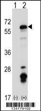 Anti-FYN Rabbit Polyclonal Antibody