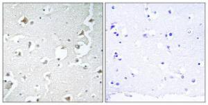 Immunohistochemical analysis of paraffin-embedded human brain tissue using Anti-JIP1 Antibody The right hand panel represents a negative control, where the antibody was pre-incubated with the immunising peptide