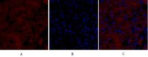 Anti-iNOS antibody