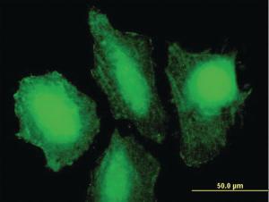 Anti-TP53 Mouse Polyclonal Antibody