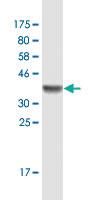 Anti-SETDB1 Mouse Monoclonal Antibody [clone: 4E8]