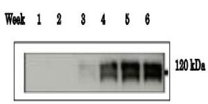 Anti-ADAM1B Antibody