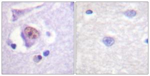 Immunohistochemical analysis of paraffin-embedded human brain tissue using Anti-SOX9 Antibody The right hand panel represents a negative control, where the antibody was pre-incubated with the immunising peptide