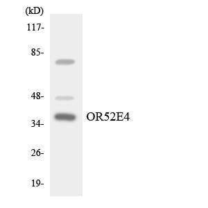 Anti-OR52E4 Rabbit Polyclonal Antibody