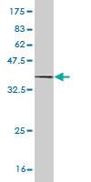 Anti-SI Mouse Monoclonal Antibody [clone: 1A8]