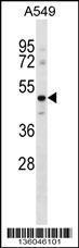 Anti-GPR37L1 Rabbit Polyclonal Antibody (AP (Alkaline Phosphatase))