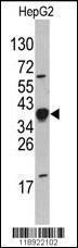 Anti-NANOG Rabbit Polyclonal Antibody (AP (Alkaline Phosphatase))