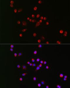 Immunofluorescence analysis of Neuro-2a cells using Anti-Nav1.8/SCN10A Antibody (A309017) at a dilution of 1:50 (40X lens). DAPI was used to stain the cell nuclei (blue)