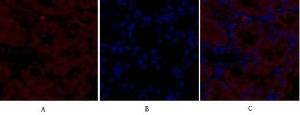 Anti-iNOS antibody