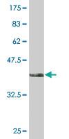 Anti-HNF1B Mouse Monoclonal Antibody [clone: 3H4]