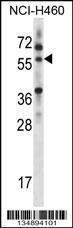 Anti-MINPP1 Rabbit Polyclonal Antibody