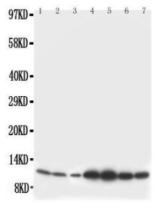 Anti-S100 beta Rabbit Polyclonal Antibody