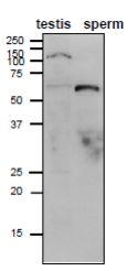 Anti-ADAM1B Antibody