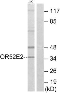 Western blot analysis of lysates from Jurkat cells using Anti-OR52E2 Antibody. The right hand lane represents a negative control, where the Antibody is blocked by the immunising peptide