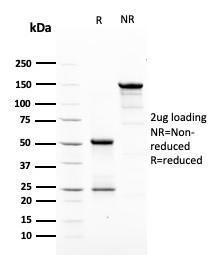 SDS-PAGE analysis of Anti-HER2 Antibody [ERBB2/3079] under non-reduced and reduced conditions; showing intact IgG and intact heavy and light chains, respectively. SDS-PAGE analysis confirms the integrity and purity of the antibody