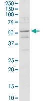 Anti-ACADM Rabbit Polyclonal Antibody