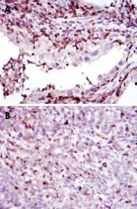 Anti-ADRBK1 Mouse Monoclonal Antibody [clone: 3F8]