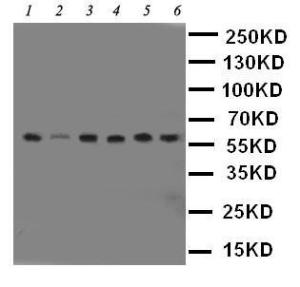 Anti-PAK1 Rabbit Polyclonal Antibody