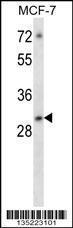 Anti-ATF5 Rabbit Polyclonal Antibody (AP (Alkaline Phosphatase))