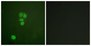 Immunofluorescence analysis of A549 cells using Anti-SOX9 Antibody The right hand panel represents a negative control, where the antibody was pre-incubated with the immunising peptide