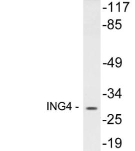 Western blot analysis of lysates from 293 cells using Anti-ING4 Antibody