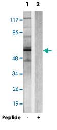 Anti-CHEK2 Rabbit Polyclonal Antibody