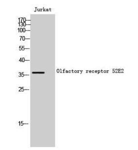 Western blot analysis of Jurkat cells using Anti-OR52E2 Antibody