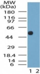 Anti-NTR2 Rabbit Polyclonal Antibody