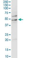 Anti-ACADM Rabbit Polyclonal Antibody