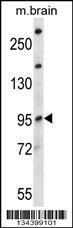 Anti-NEDD4L Rabbit Polyclonal Antibody (Biotin)