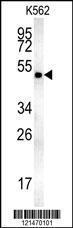 Anti-MINPP1 Rabbit Polyclonal Antibody (Biotin)