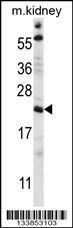 Anti-TTC33 Rabbit Polyclonal Antibody (Biotin)