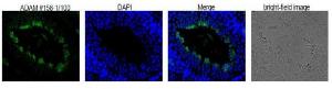 Anti-ADAM1B Antibody