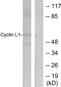 Western blot analysis of lysates from HepG2 cells using Anti-Cyclin L1 Antibody. The right hand lane represents a negative control, where the antibody is blocked by the immunising peptide.