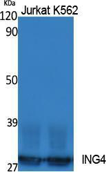 Western blot analysis of extracts from Jurkat, K562 cells using Anti-ING4 Antibody