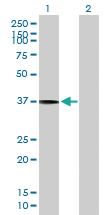 Anti-SLC17A3 Mouse Polyclonal Antibody