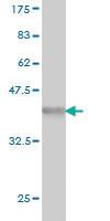 Anti-PARP1 Mouse Monoclonal Antibody [clone: 3G4]