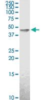 Anti-ACADM Rabbit Polyclonal Antibody