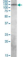 Anti-PREX1 Goat Polyclonal Antibody