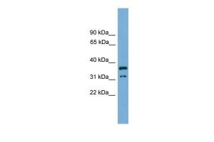 Anti-KCTD21 Rabbit Polyclonal Antibody