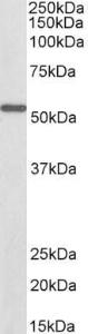 Anti-ALDH6A1 Antibody (A83036/Biotin) (0.1 µg/ml) staining of Mouse Kidney lysate (35 µg protein in RIPA buffer)