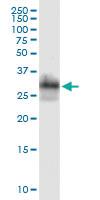 Anti-NME2 Antibody Pair