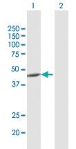 Anti-ACADM Rabbit Polyclonal Antibody