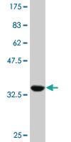 Anti-HNF1B Mouse Monoclonal Antibody [clone: 3E11]