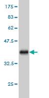 Anti-SEC24D Mouse Monoclonal Antibody [clone: 1A8]