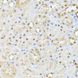 Immunohistochemistry analysis of paraffin-embedded mouse kidney using Anti-CSNK2A1 Antibody (A307776) at a dilution of 1:100 (40x lens). Perform microwave antigen retrieval with 10 mM PBS buffer pH 7.2 before commencing with IHC staining protocol.